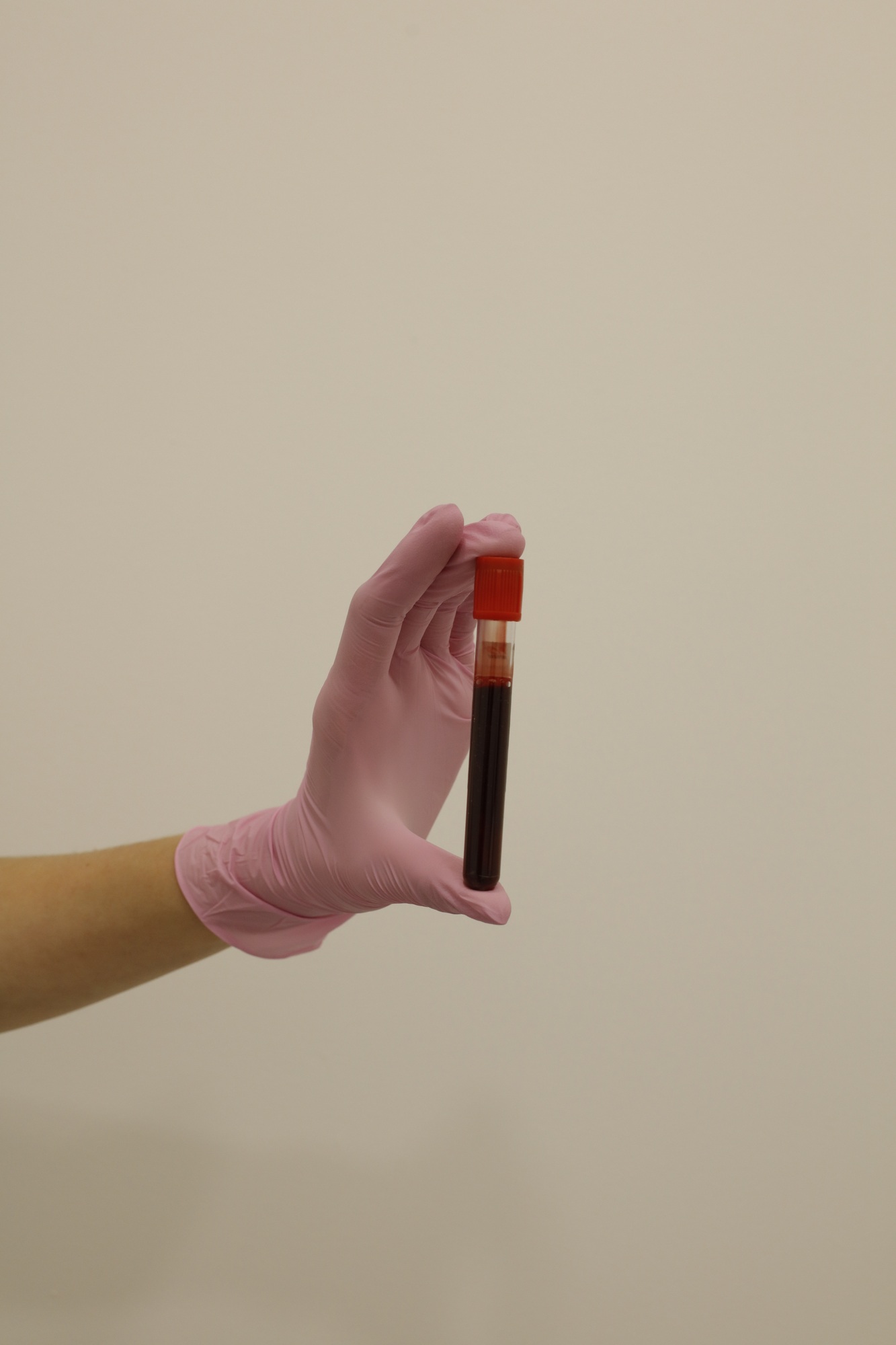 Elevated BNP Levels Explained